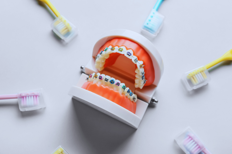 Ideas De Actividades Para Ense Ar A Los Ni Os La Importancia De La Higiene Dental Durante Las